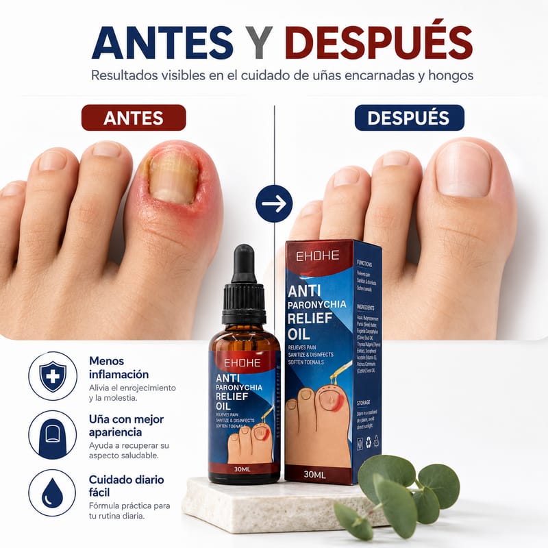 Recupera el aspecto saludable de tus uñas desde casa - Fácil aplicación • Envío Gratis • Pago Contra Entrega