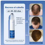 Roll-On Capilar: Detén la caída y recupera tu volumen desde la raíz