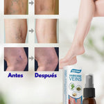Spray para varices