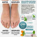 Fungus Eliminator de PureHealth Research